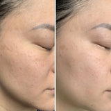 Radiance Grape Stem Cell + Squalane Ultra-Hydrating Cream