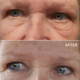 EyeHero Bio-Retinol Smoothing Eye Cream