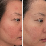 Replenish Ceramides + Blueberry Barrier Repair Serum