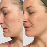 Refresh Papaya + Salicylic Acid Cleanser